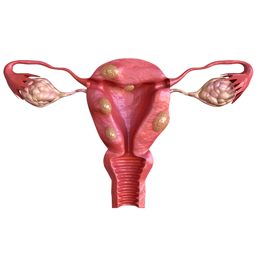 Is surgery necessary for uterine fibroids?